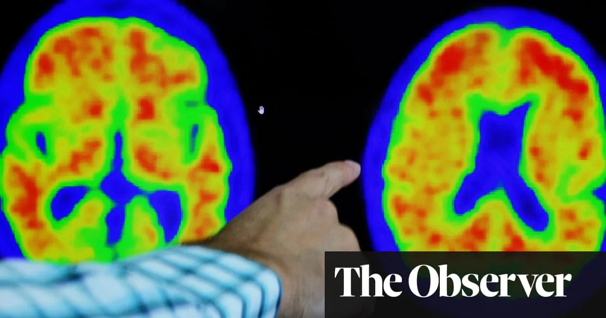 Revealing Study Shows Cancer Survivors May Have Lower Alzheimer’s Risk Than Expected