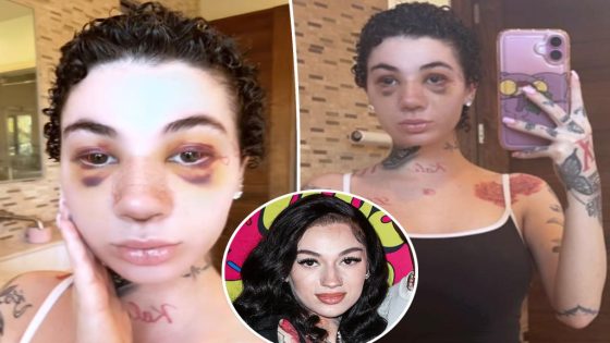 Bhad Bhabie reveals nose job as she clears up rumors about her cancer battle