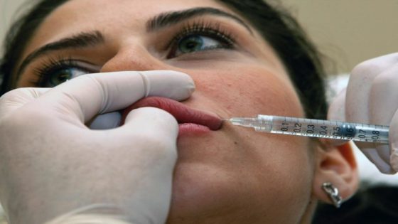 Ook bij deze vrouwen liep een behandeling met fillers of botox mis: “Nooit meer laat ik zoiets in mijn lichaam spuiten” - Het Nieuwsblad