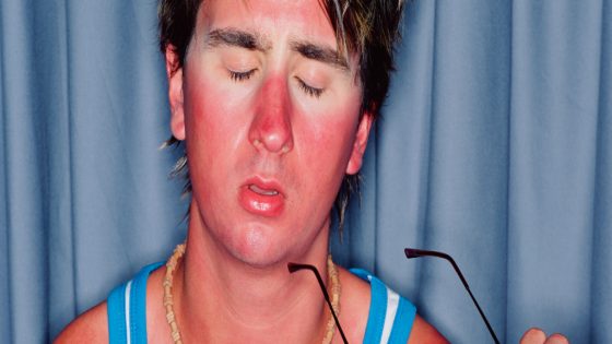 We've Been Wrong About What Causes Sunburn, Scientists Discover : ScienceAlert