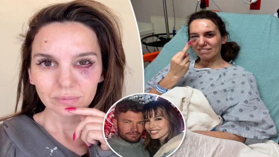 Christy Carlson Romano is 'grateful to be alive' after getting 'shot in the face' during husband's birthday