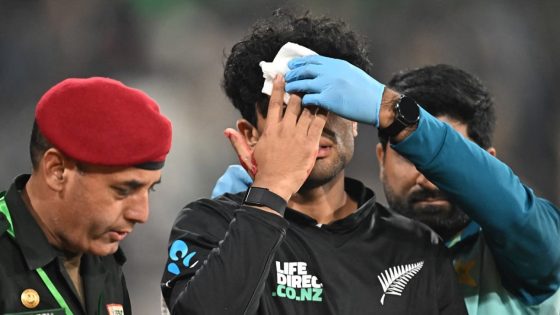 Pak vs NZ - ODI tri-series - Rachin Ravindra goes off the field after taking blow to forehead