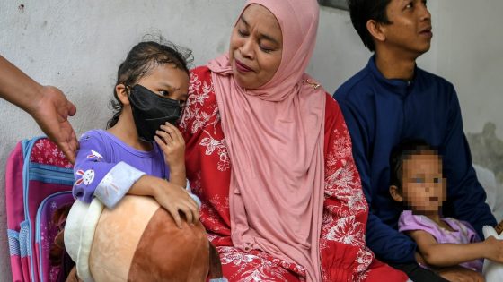 Nasib kanak-kanak cedera dipercayai dipukul ibu dapat perhatian menteri - Harian Metro