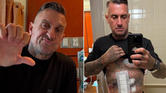 Carey Hart Hospitalized with Severed Small Intestine