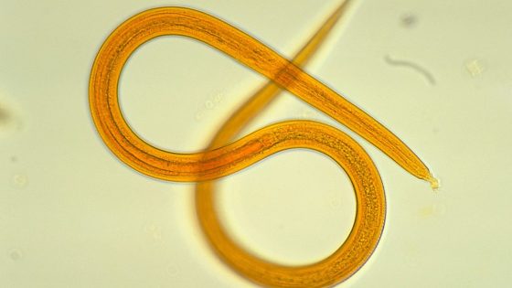 Man’s health crashes after getting donated kidney—it was riddled with worms