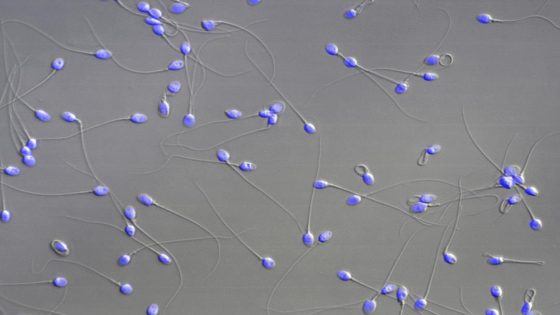 After 19 Years of Trying, She's Pregnant—Thanks to AI