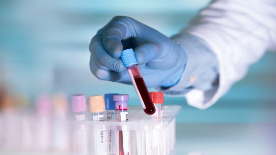 Japanese Scientists Develop Artificial Blood