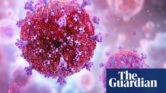 Breakthrough in search for HIV cure leaves researchers ‘overwhelmed’ | Global development