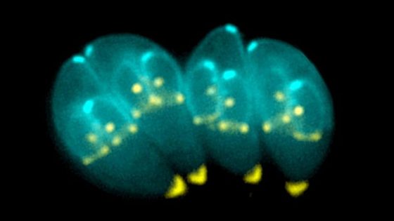 Brain Parasite From Meat and Cat Poop Disrupts Human Neuron Communications