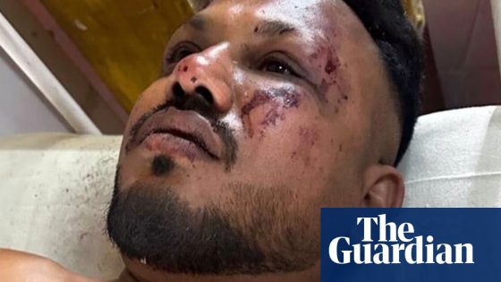 ‘I saw people dying in front of my eyes’: British survivor describes Air India crash | Air India Ahmedabad plane crash