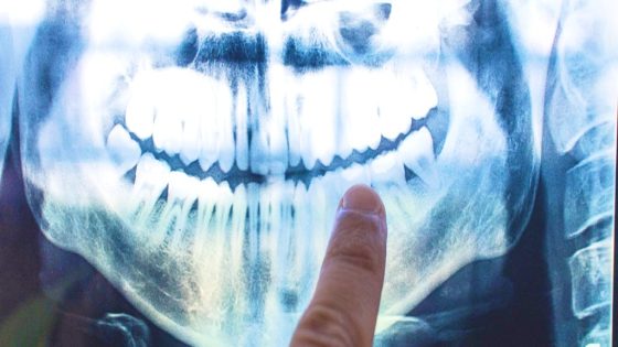 The Cause of Alzheimer's Might Be Coming From Within Your Mouth : ScienceAlert