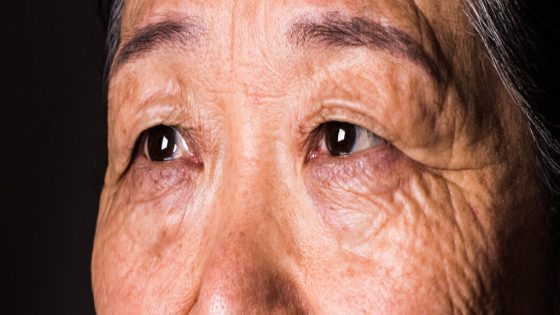 Your Vision Can Predict Dementia 12 Years Before a Diagnosis, Study Discovers : ScienceAlert