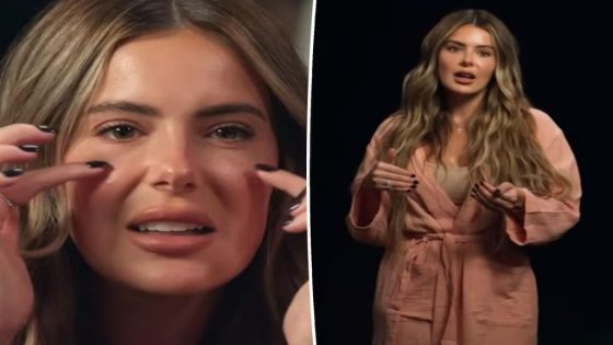 Brielle Biermann admits regrets over getting filler at young age