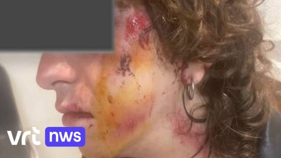 Vrouw bewusteloos geslagen bij homofobe aanval aan Zuidstation in Brussel