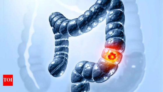 Colon Cancer Symptoms: Colon cancer rising among youngsters: Top US doc alerts about 5 warning signs |