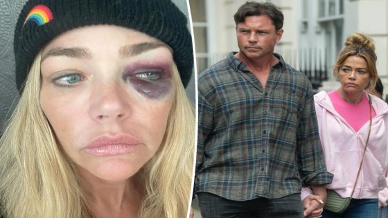 Denise Richards accuses estranged husband Aaron Phypers of trying to kill her during violent outbursts