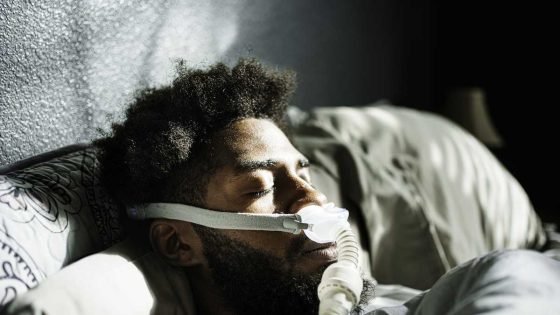 Doctor on research showing that sleep apnea diagnoses could double by the end of the 21st century
