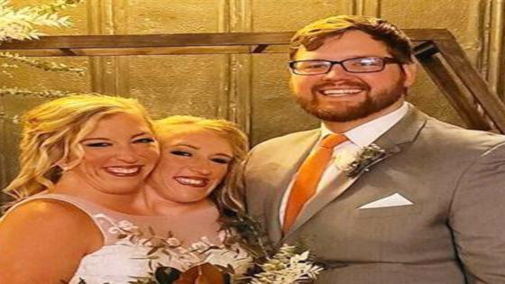 Conjoined Twins Abby and Brittany Hensel Step Out for Rare Outing - E! Online