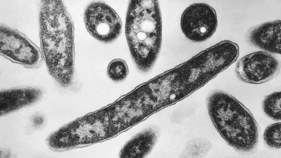 Legionnaires’ disease outbreak in New York City grows to 58 illnesses, 2 deaths