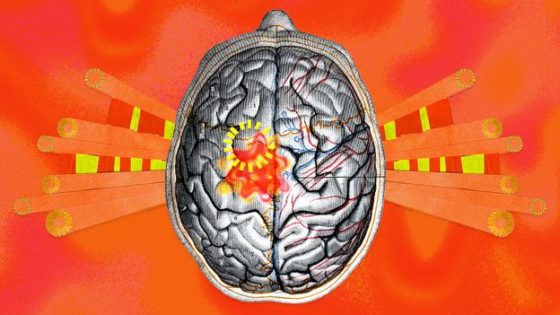 The world is getting hotter – this is what it is doing to our brains - BBC