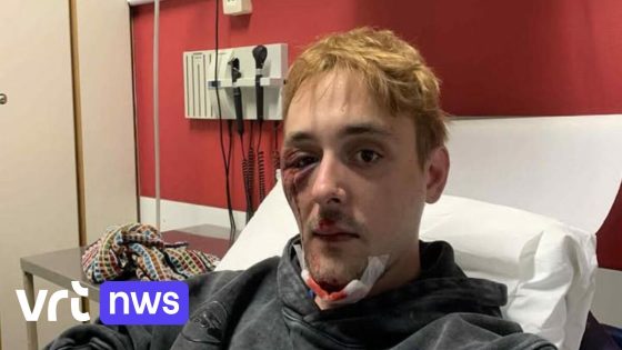 Jongeman (23) aangevallen na feestje in Hoegaarden: "Verschillende breuken in het gezicht"